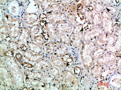 Fig1:; Immunohistochemical analysis of paraffin-embedded human-kidney, antibody was diluted at 1:200