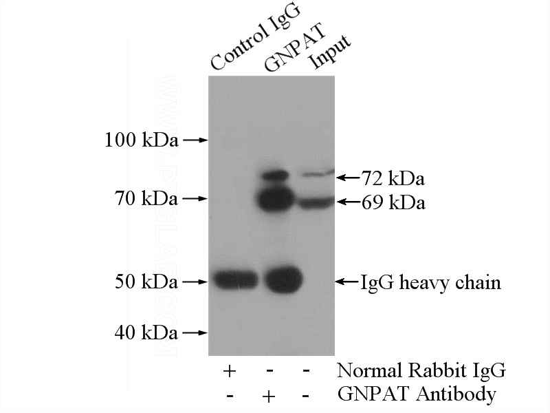 IP Result of anti-GNPAT (IP:Catalog No:111007, 4ug; Detection:Catalog No:111007 1:500) with COLO 320 cells lysate 2400ug.