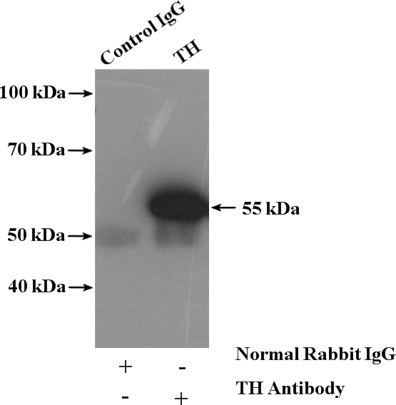 IP Result of anti-TH (IP:Catalog No:116034, 4ug; Detection:Catalog No:116034 1:500) with mouse brain tissue lysate 3680ug.