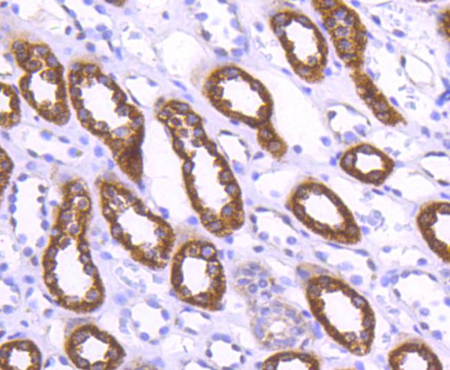 Fig2:; Immunohistochemical analysis of paraffin-embedded human kidney tissue using anti-WASF2 antibody. The section was pre-treated using heat mediated antigen retrieval with Tris-EDTA buffer (pH 8.0-8.4) for 20 minutes.The tissues were blocked in 5% BSA for 30 minutes at room temperature, washed with ddH; 2; O and PBS, and then probed with the primary antibody ( 1/50) for 30 minutes at room temperature. The detection was performed using an HRP conjugated compact polymer system. DAB was used as the chromogen. Tissues were counterstained with hematoxylin and mounted with DPX.