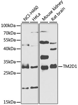 Western blot - TM2D1 Polyclonal Antibody 