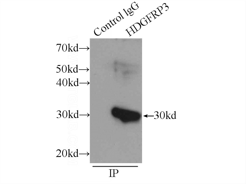 IP Result of anti-HDGFRP3 (IP:Catalog No:111387, 3ug; Detection:Catalog No:111387 1:300) with mouse testis tissue lysate 4800ug.