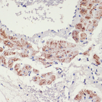 Immunohistochemistry - ADRA1A Polyclonal Antibody 