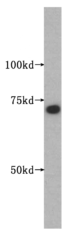 COLO 320 cells were subjected to SDS PAGE followed by western blot with Catalog No:115403(SMTNL2 antibody) at dilution of 1:500