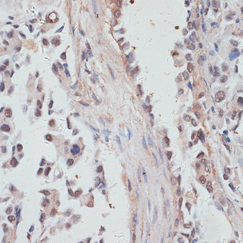 Immunohistochemistry - NCOA4 Polyclonal Antibody 