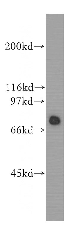 human ileum tissue were subjected to SDS PAGE followed by western blot with Catalog No:111574(HSPA2 antibody) at dilution of 1:300