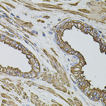 Immunohistochemistry - FLNB Polyclonal Antibody 