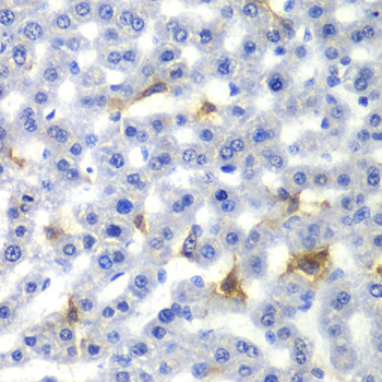 Immunohistochemistry - NR0B2 Polyclonal Antibody 