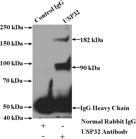 IP Result of anti-USP32 (IP:Catalog No:116605, 4ug; Detection:Catalog No:116605 1:500) with HeLa cells lysate 4000ug.