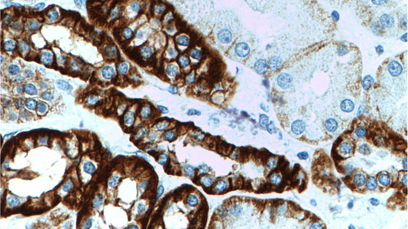 Immunohistochemistry of paraffin-embedded human kidney tissue slide using Catalog No:108773(CDH16 Antibody) at dilution of 1:200 (under 40x lens).