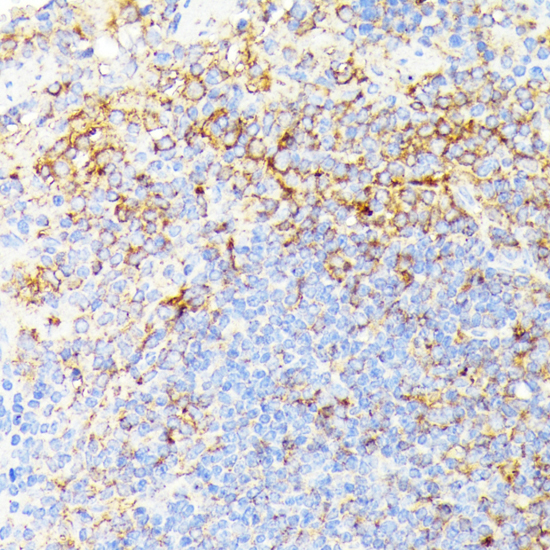 Immunohistochemistry - RIPK1 Polyclonal Antibody 