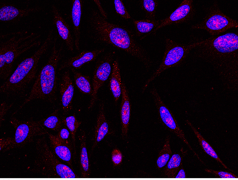 Human NR3C1 Immunofluorescence(IF) 14606