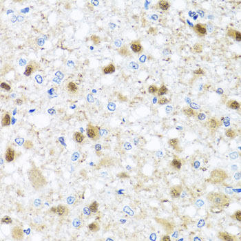 Immunohistochemistry - ZBTB17 Polyclonal Antibody 