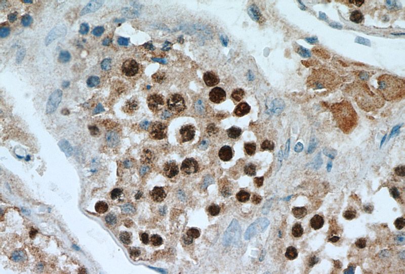 Immunohistochemical of paraffin-embedded human testis using Catalog No:115533(SPAG5 antibody) at dilution of 1:100 (under 40x lens)
