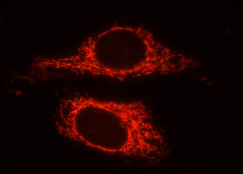Immunofluorescent analysis of HepG2 cells using Catalog No:111220(GRP75 Antibody) at dilution of 1:25 and Rhodamine-Goat anti-Rabbit IgG