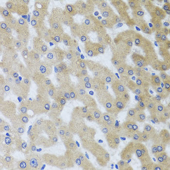Immunohistochemistry - UVRAG Polyclonal Antibody 