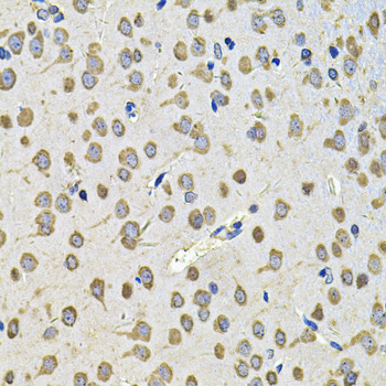 Immunohistochemistry - EIF3F Polyclonal Antibody 