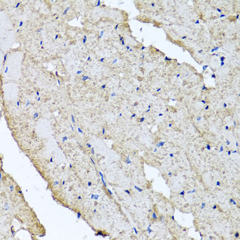 Immunohistochemistry - USH1C Polyclonal Antibody 