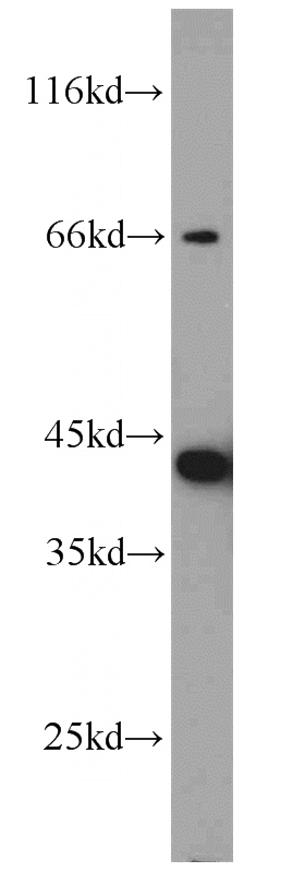 mouse liver tissue were subjected to SDS PAGE followed by western blot with Catalog No:108196(ARL13B antibody) at dilution of 1:1000
