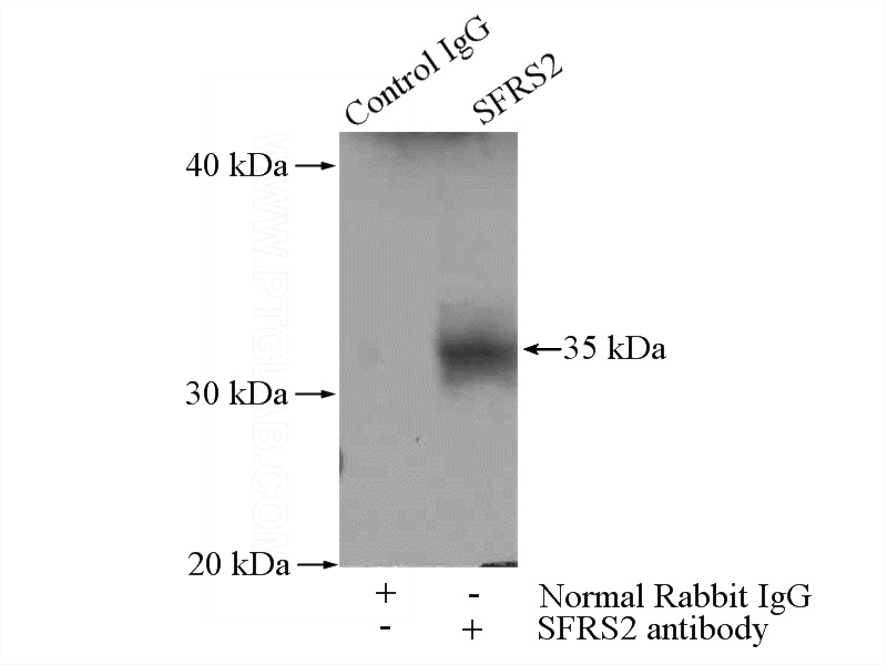 IP Result of anti-SFRS2 (IP:Catalog No:115149, 4ug; Detection:Catalog No:115149 1:300) with mouse brain tissue lysate 4000ug.