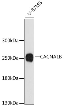 Western blot - CACNA1B Polyclonal Antibody 
