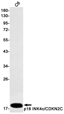 Western blot detection of p18 INK4c/CDKN2C in C6 cell lysates using p18 INK4c/CDKN2C Rabbit mAb(1:500 diluted).Predicted band size:18kDa.Observed band size:18kDa.
