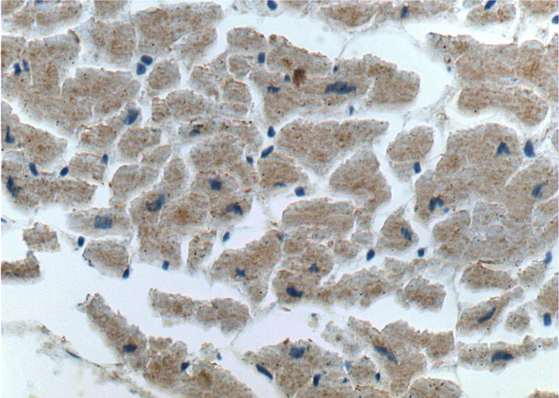 Immunohistochemistry of paraffin-embedded human heart tissue slide using Catalog No:107710(ACTN2 Antibody) at dilution of 1:200 (under 40x lens).