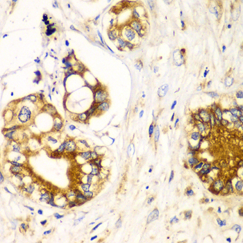 Immunohistochemistry - RPN1 Polyclonal Antibody 
