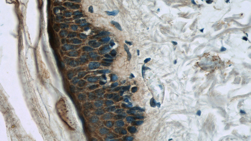 Immunohistochemistry of paraffin-embedded human skin tissue slide using Catalog No:112297(LOR Antibody) at dilution of 1:50 (under 40x lens)