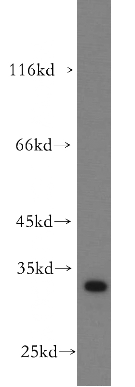 mouse brain tissue were subjected to SDS PAGE followed by western blot with Catalog No:114329(PTPRR antibody) at dilution of 1:500