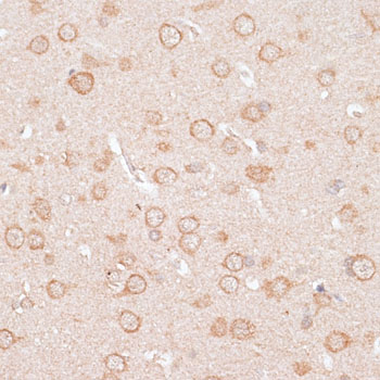 Immunohistochemistry - KCNJ4 Polyclonal Antibody 