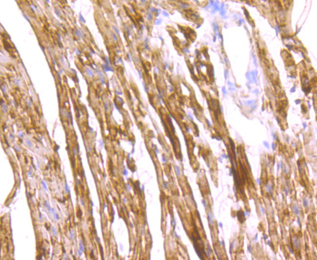 Fig3: Immunohistochemical analysis of paraffin-embedded mouse heart tissue using anti- Cardiac FABP3 antibody. Counter stained with hematoxylin.