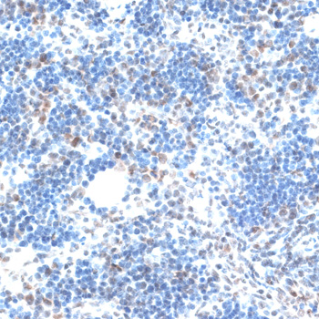 Immunohistochemistry - AQR Polyclonal Antibody 