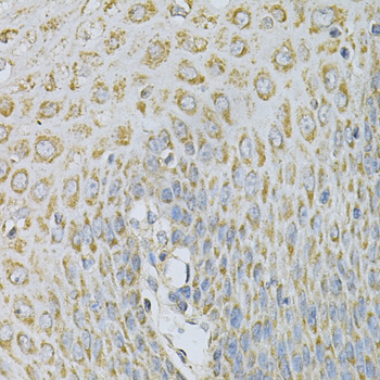 Immunohistochemistry - AP2B1 Polyclonal Antibody 