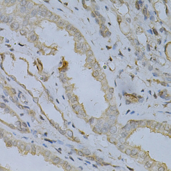 Immunohistochemistry - ACADM Polyclonal Antibody 