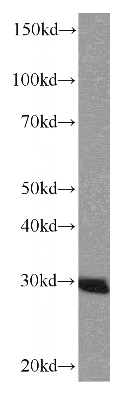 HEK-293 cells were subjected to SDS PAGE followed by western blot with Catalog No:107059(ANP32B Antibody) at dilution of 1:1000