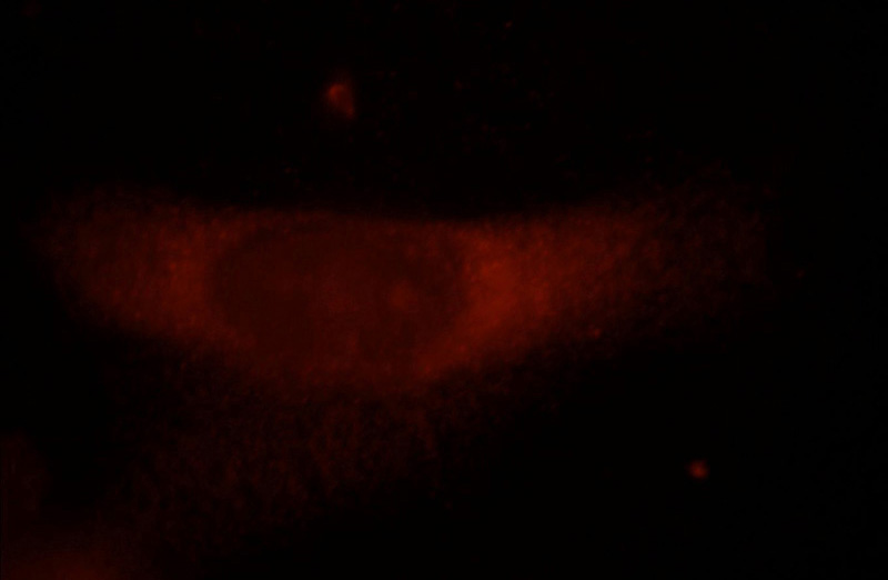 Immunofluorescent analysis of Hela cells, using FAM124B antibody Catalog No:110467 at 1:25 dilution and Rhodamine-labeled goat anti-rabbit IgG (red).