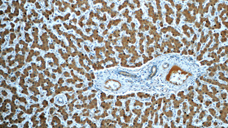 Immunohistochemistry of paraffin-embedded human liver tissue slide using Catalog No:117340(TF Antibody) at dilution of 1:50 (under 10x lens)