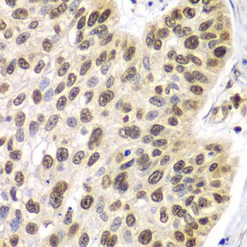 Immunohistochemistry - SEPT7 Polyclonal Antibody 