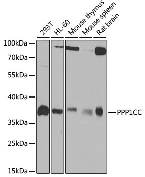 Western blot - PPP1CC Polyclonal Antibody 
