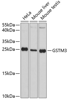 Western blot - GSTM3 Polyclonal Antibody 