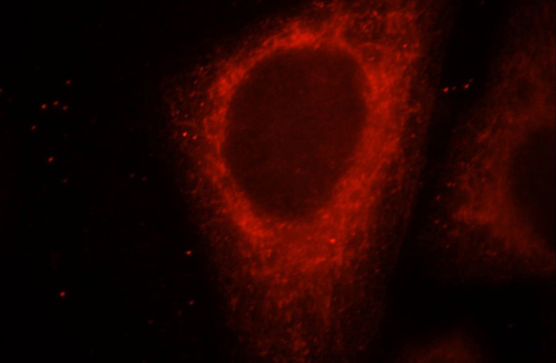 Immunofluorescent analysis of HepG2 cells, using UQCRC1 antibody Catalog No:116635 at 1:25 dilution and Rhodamine-labeled goat anti-rabbit IgG (red).