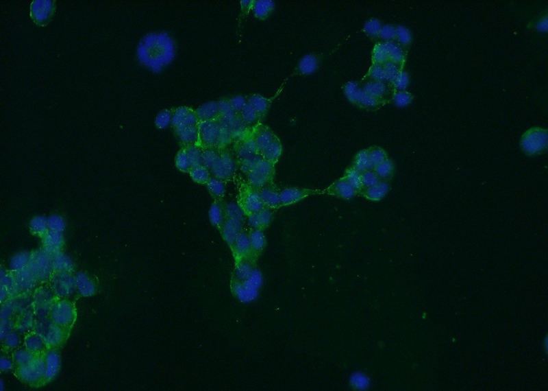 Immunofluorescent analysis of HEK-293 cells using Catalog No:111058(GPATCH4 Antibody) at dilution of 1:50 and Alexa Fluor 488-congugated AffiniPure Goat Anti-Rabbit IgG(H+L)