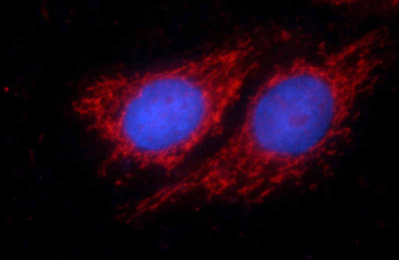 Immunofluorescent analysis of HepG2 cells using Catalog No:113560(p70(S6K) Antibody) at dilution of 1:25 and Rhodamine-Goat anti-Rabbit IgG