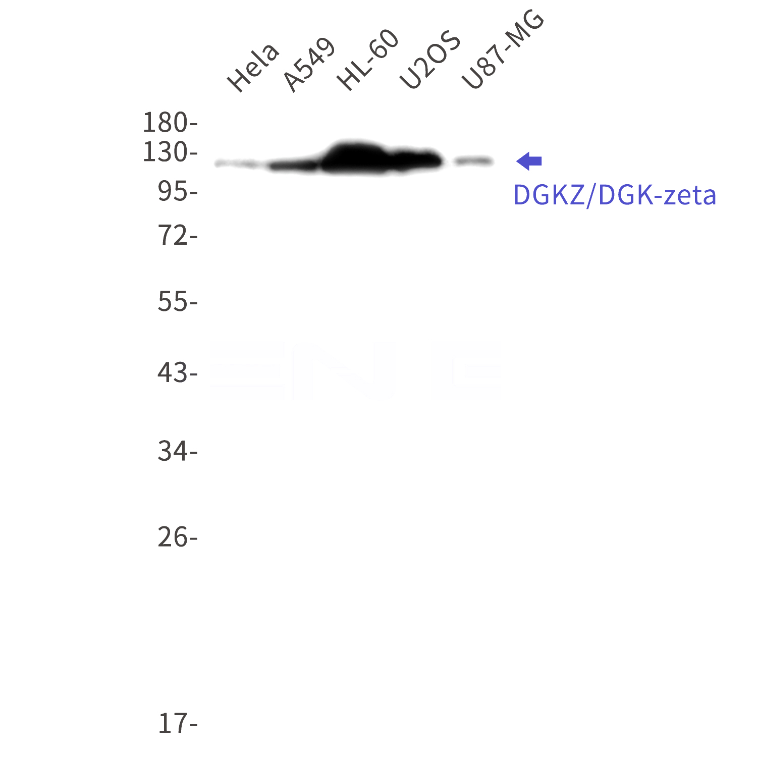 Western blot detection of DGKZ/DGK-zeta in Hela,A549,HL-60,U2OS,U87-MG cell lysates using DGKZ/DGK-zeta Rabbit mAb(1:1000 diluted).Predicted band size:104kDa.Observed band size:124,114kDa.