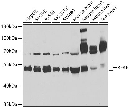 Western blot - BFAR Polyclonal Antibody 
