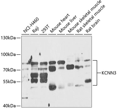 Western blot - KCNN3 Polyclonal Antibody 