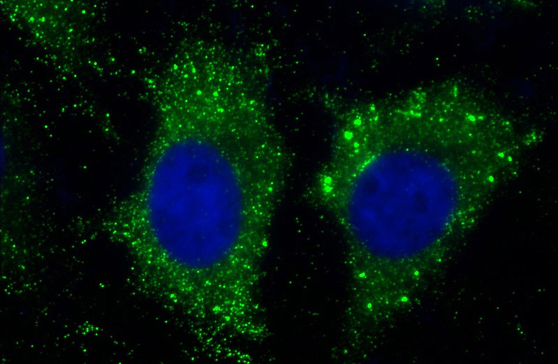 Immunofluorescent analysis of (10% Formaldehyde) fixed HeLa cells using Catalog No:114198(PRKAR2B Antibody) at dilution of 1:50 and Alexa Fluor 488-congugated AffiniPure Goat Anti-Rabbit IgG(H+L)