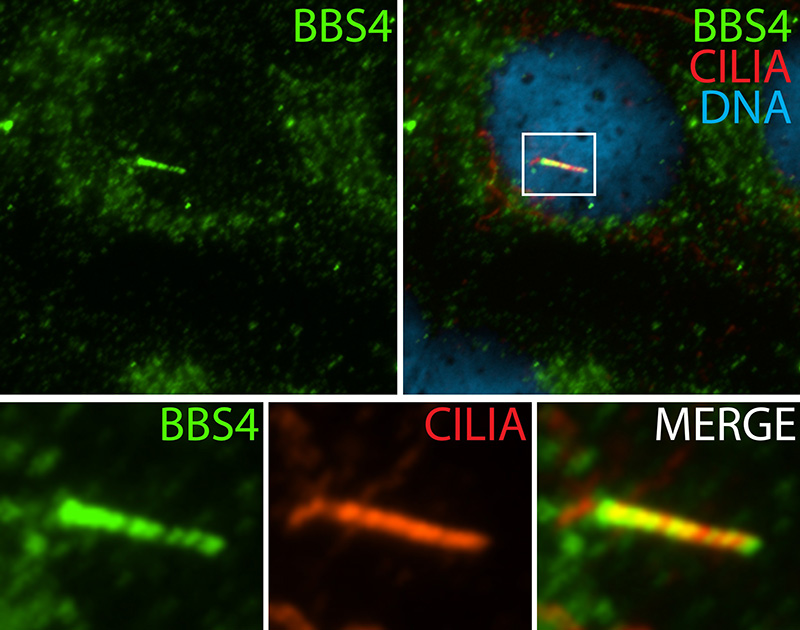 IF result (cytoplasm and the length of cilia cilia stain) of anti-BBS4 (Catalog No:108371; 1:50) with serum-starved hTERT-RPE1 cell (MeOH fixed) by Dr. Moshe Kim.