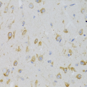 Immunohistochemistry - KISS1R Polyclonal Antibody 